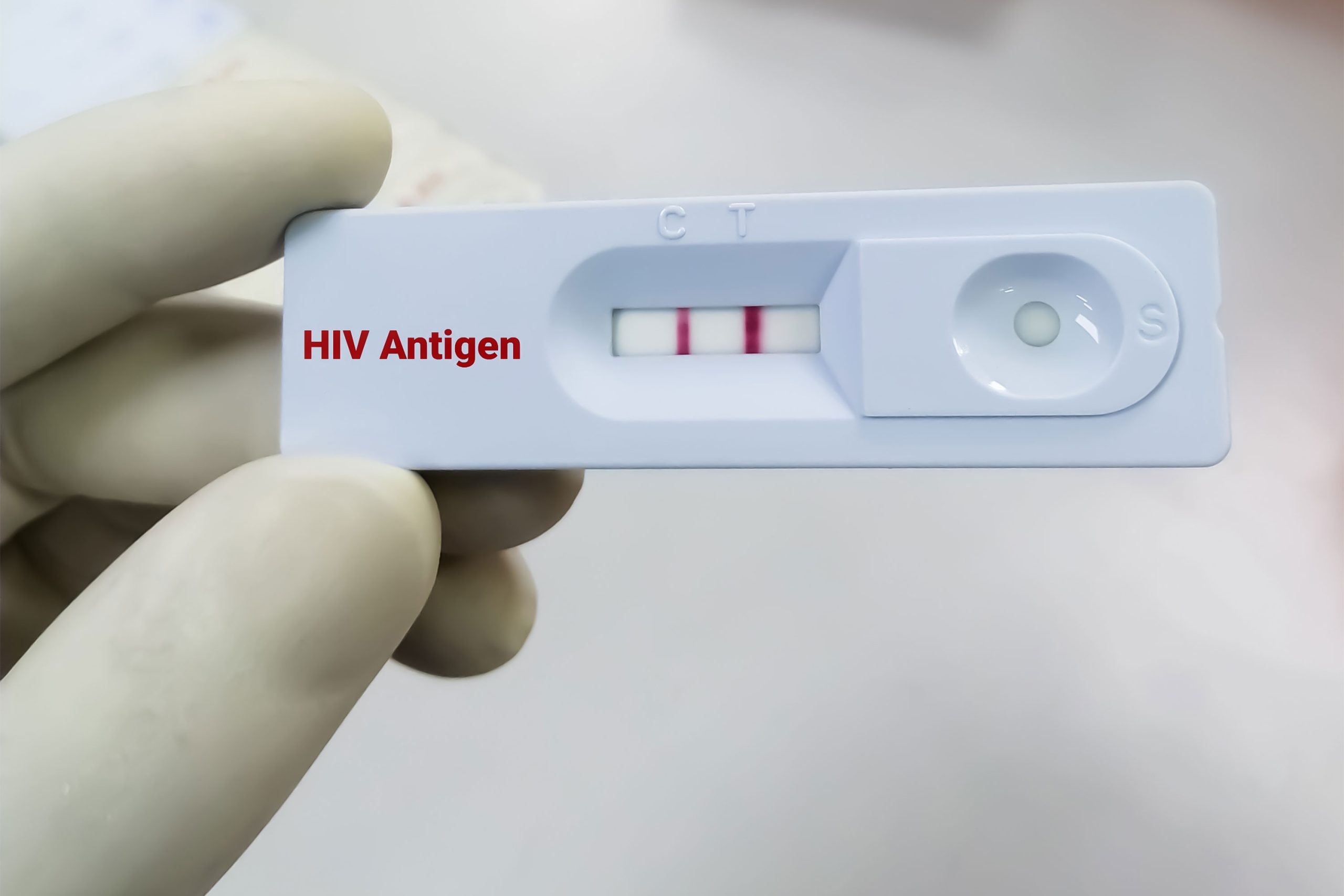 AAR Health Services Faces Accusations of HIV Misdiagnosis in Uganda