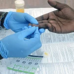 Ugandan Scientists Investigate Indigenous HIV Virus Types