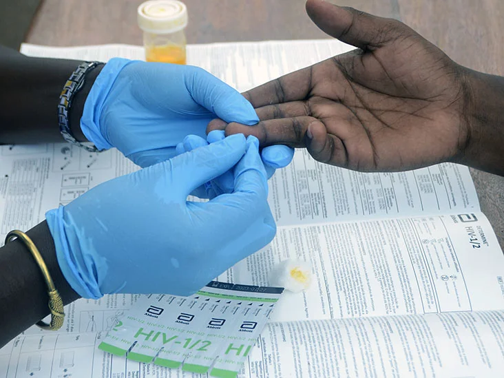 Ugandan Scientists Investigate Indigenous HIV Virus Types