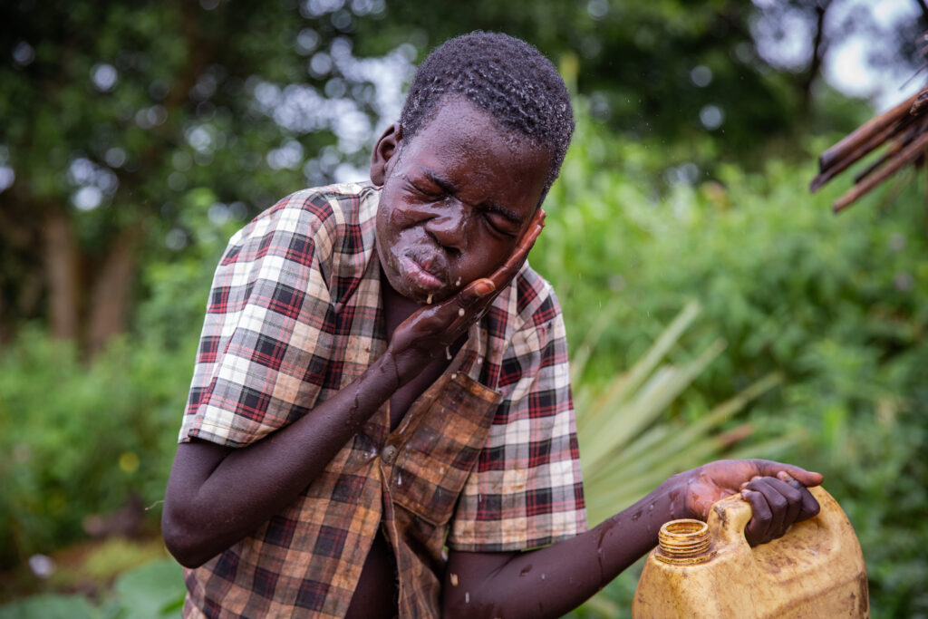 Silent Crisis: Nodding Syndrome Grips Northern Uganda