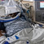 government clarifies on mulago kidney transplant charges