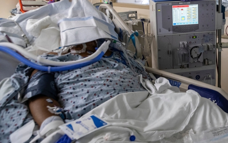 government clarifies on mulago kidney transplant charges