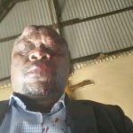 Uganda Police Probe Assault on MP in Land Dispute