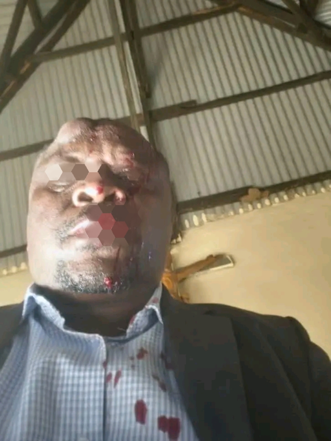 Uganda Police Probe Assault on MP in Land Dispute