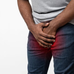 Penile Cancer on the Rise in Uganda as 220 Cases Reported