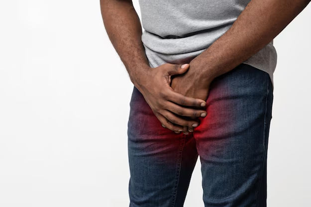 Penile Cancer on the Rise in Uganda as 220 Cases Reported