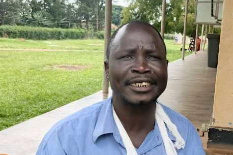 Kamuli Man Loses Hand After Catching Wife with Neighbour