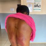 Court Rejects Compensation for Naalya Teacher Injured While Chasing Student