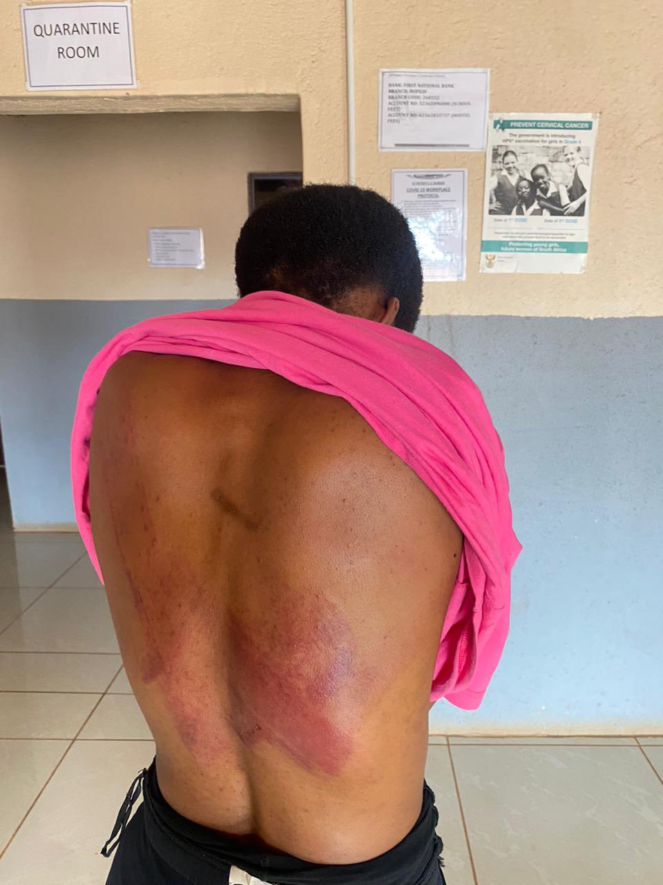 Court Rejects Compensation for Naalya Teacher Injured While Chasing Student