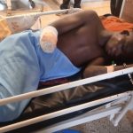 Residents of Etoko village in Maracha accused him of terrorizing their community from 2017 to 2023, leading to significant unrest. His criminal activities reportedly forced some residents to flee the area. Eyotre’s luck ran out on November 16, 2024, when he was caught stealing a goat in Owapi village, Terego District. A mob apprehended him, cutting off his right hand and inflicting deep machete wounds on his left leg.